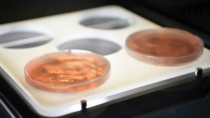 Су тасқыны салдарынан жұқпалы аурулардың пайда болу қаупі бар ма: ДСМ мәлімдеме жасады