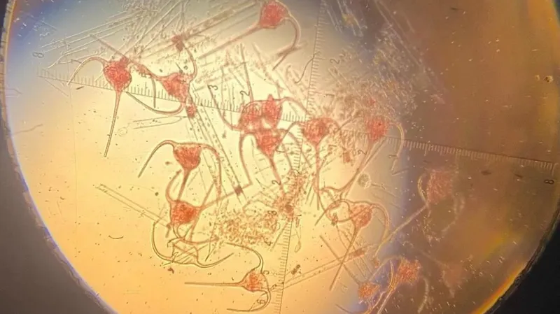 Каспийден бөгде әрі қауіпті фитопланктон табылды