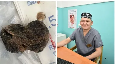 Ота, шаш, Жамбыл облысы, асқазан, сурет - Zakon.kz жаңалық 30.07.2025 21:38