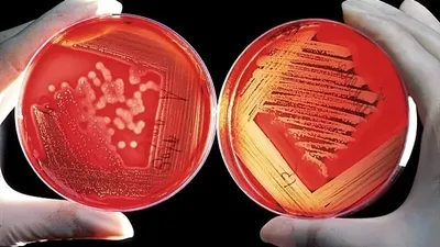 Вирус, Қытай, чикунгунья  , сурет - Zakon.kz жаңалық 10.08.2025 15:22