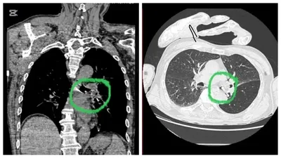 Қонаев тұрғыны алманың кесірінен ажал құша жаздады, сурет - Zakon.kz жаңалық 25.08.2025 17:43