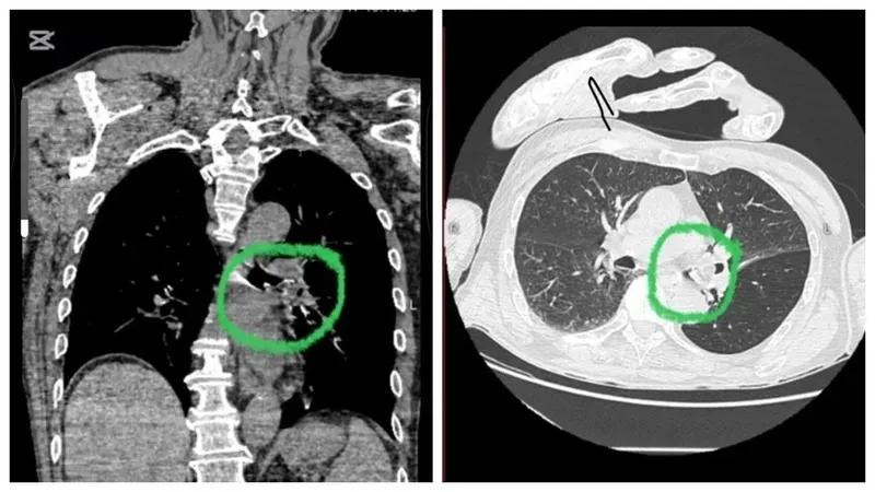 Қонаев тұрғыны алманың кесірінен ажал құша жаздады