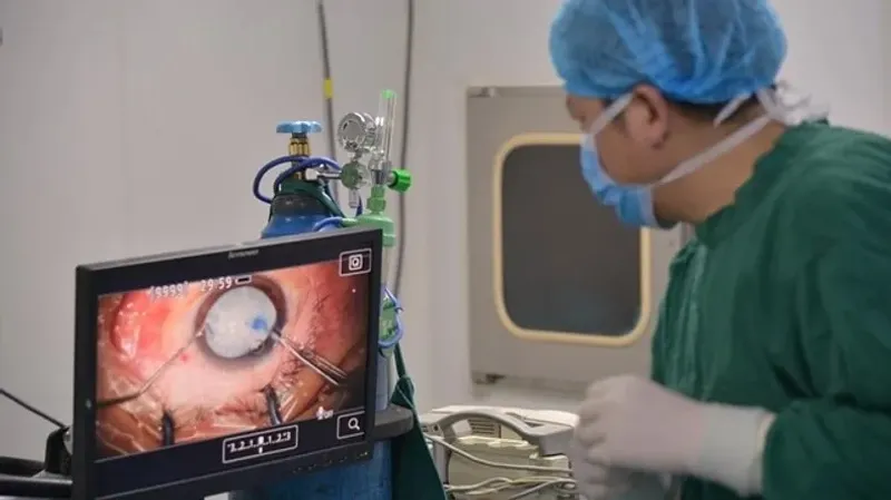 Қытайда ер адамның миынан ұзындығы 18 см болатын құрт табылды