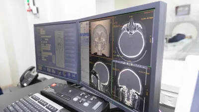 Әділет министрлігі виртуалды мәйіт ашу әдісінің дәлдігі туралы айтып берді , сурет - Zakon.kz жаңалық 24.09.2025 14:47