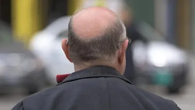 Тайваньдық мамандар май қышқылдары "ұйықтап жатқан" шаш фолликулдарын оятып, шаш өсуін бастауға қабілетті екенін анықтады. Ғалымдар бұл ашылымды май жасушалары мен стволдық жасушалар арасындағы "метаболикалық қарым-қатынас" деп атайды, деп хабарлайды Zakon.kz., сурет - Zakon.kz жаңалық 27.10.2025 15:53