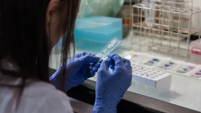 Алматы облысы әкімдігі Байсерке ауылындағы сібір жарасы жағдайына түсінік берді, сурет - Zakon.kz жаңалық 08.11.2025 12:15