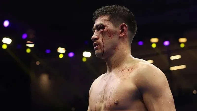 Дмитрий Биволдың көптен күткен жекпе-жегі өтпей қалуы мүмкін