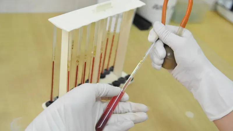 Денсаулық сақтау министрлігі қызылшаның өршуіне байланысты мәлімдеме жасады